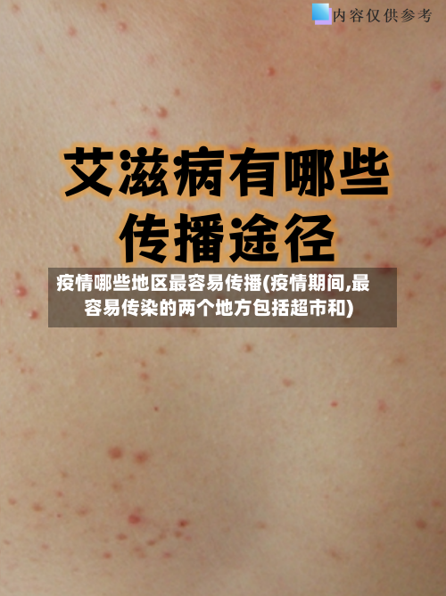 疫情哪些地区最容易传播(疫情期间,最容易传染的两个地方包括超市和)-第3张图片