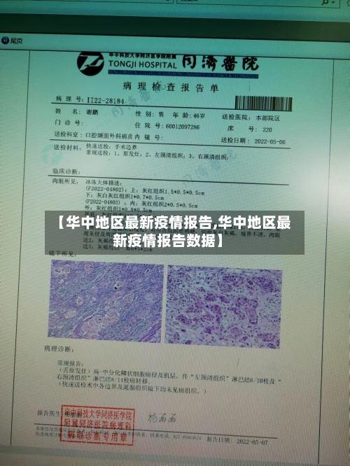 【华中地区最新疫情报告,华中地区最新疫情报告数据】